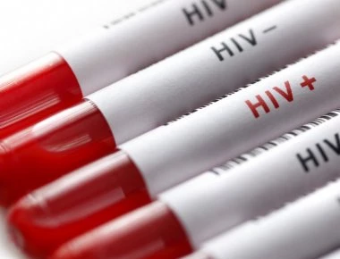 Ποια τα πρώτα συμπτώματα της λοίμωξης από HIV στους άνδρες